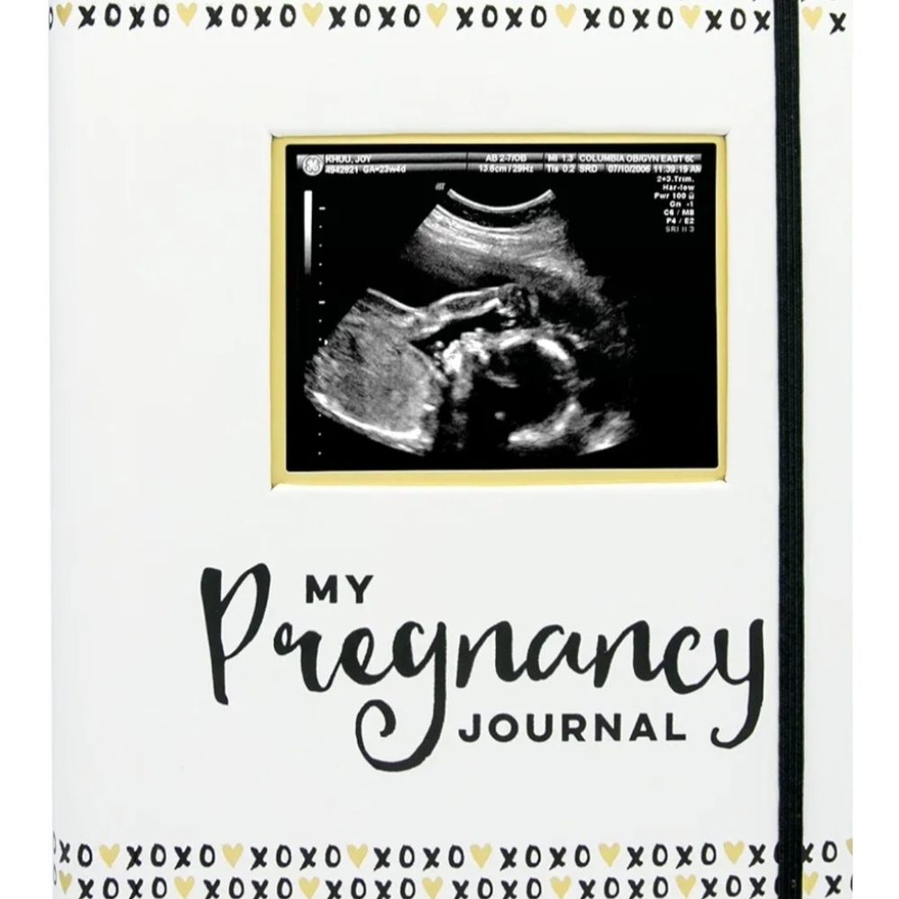 White Pregnancy Journal with Black Accents